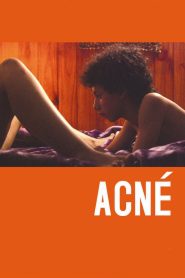فيلم Acné مترجم للكبار فقط